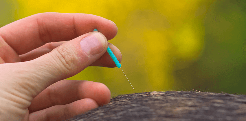 Acupuncture